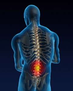 back pain surgery