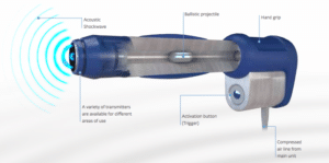 shockwave therapy edmonton
